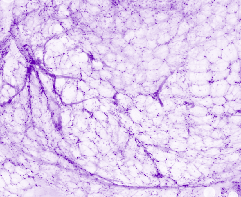 Prostatic fatty tissue with capillaries