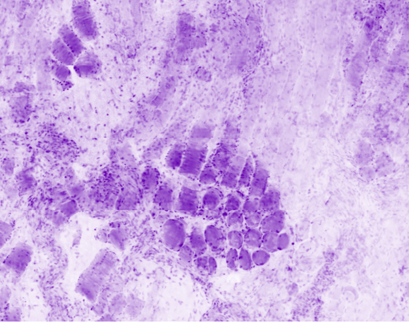 Skin specimen - Skeletal muscle